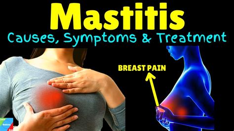 mastitis hole in breast|signs of a mastitis.